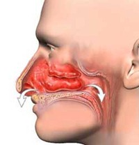 Post Nasal Drip Throat Irritation 72