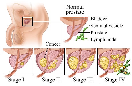 Male testosterone test